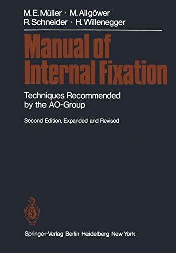 Schatzker, J. Manual of Internal Fixation: Techniques Recommended by the AO Group