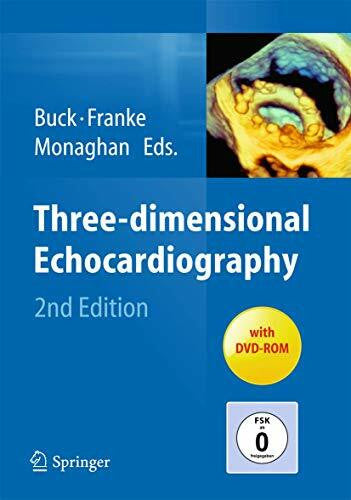 Franke, Andreas Three-dimensional Echocardiography