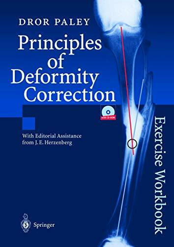 Paley, Dror Principles of Deformity Correction: Exercise Workbook