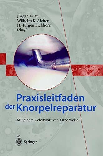 Eichhorn, H.-Jürgen Praxisleitfaden der Knorpelreparatur