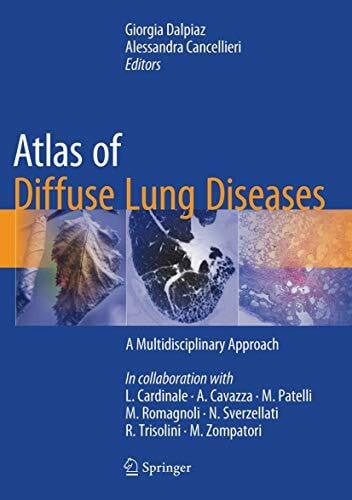 Cancellieri, Alessandra Atlas of Diffuse Lung Diseases: A Multidisciplinary Approach