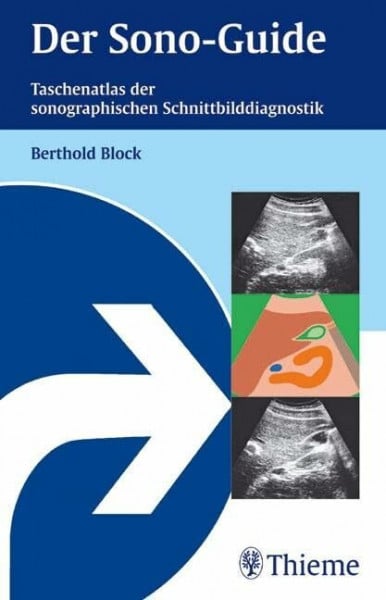 Block, Berthold Der Sono-Guide: Taschenatlas der sonographischen Schnittbilddiagnostik