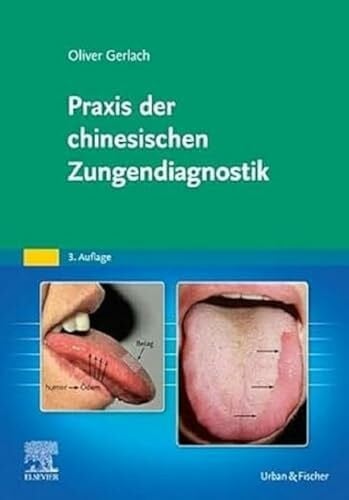 Gerlach, Oliver Praxis der chinesischen Zungendiagnostik: Vom Zungenbild zum Behandlungsplan und das Zungenbild im Therapieverlauf