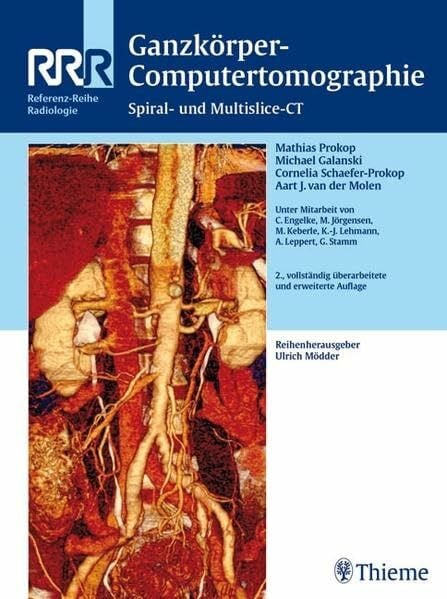 Mödder, Ulrich Ganzkörper-Computertomographie: Spiral- und Multislice-CT (Reihe, REF.-R. RADIOLOGIE)
