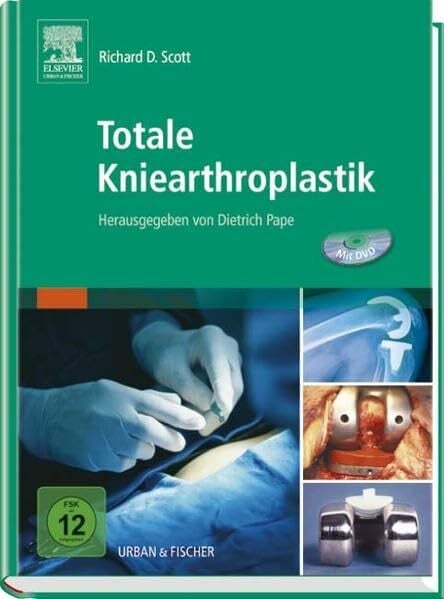 Scott, Richard D. Totale Kniearthroplastik: Herausgegeben von Dietrich Pape