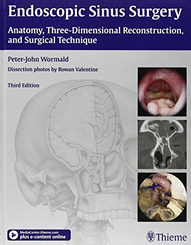 Wormald, Peter J. Endoscopic Sinus Surgery: Anatomy, Three-Dimensional Reconstruction, and Surgical Technique: Anatomy, Three-Dimensional Reconstruction, and Surgical Technique. Plus e-content online