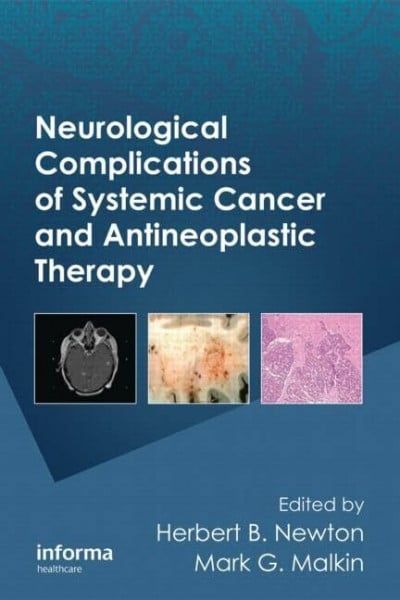 Newton, Herbert B. Neurological Complications of Systemic Cancer and Antineoplastic Therapy (Neurological Disease and Therapy, Band 96)