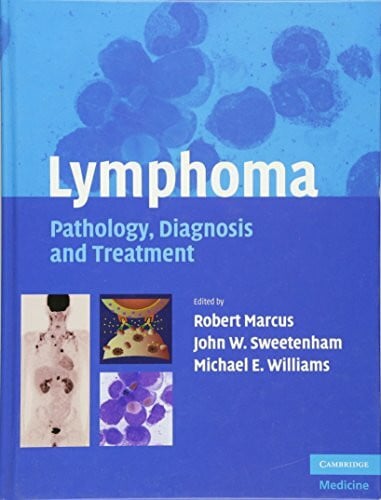 Marcus, Robert Lymphoma: Pathology, Diagnosis and Treatment