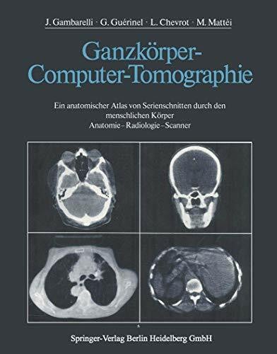 Soler, M. Ganzkörper-Computer-Tomographie: Ein anatomischer Atlas von Serienschnitten durch den menschlichen Körper Anatomie ― Radiologie ― Scanner