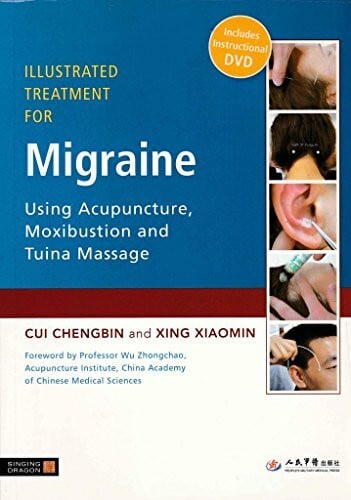 Xiaomin, Xing Illustrated Treatment for Migraine Using Acupuncture, Moxibustion and Tuina Massage