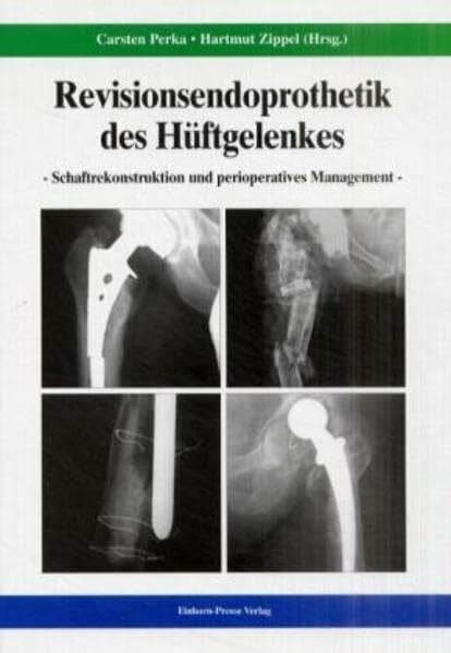 Perka, Carsten Revisionsendoprothetik des Hüftgelenks: Schaftrekonstruktion und perioperatives Management