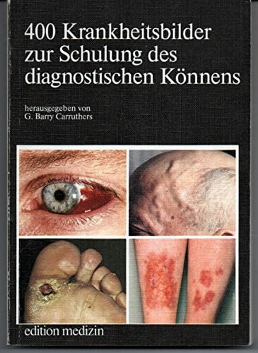 Vierhundert Krankheitsbilder zur Schulung des diagnostischen Könnens
