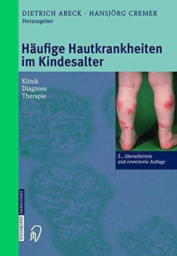 Cremer, Hansjörg Häufige Hauterkrankungen im Kindesalter. Klinik - Diagnose - Therapie