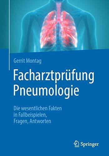 Montag, Gerrit Facharztprüfung Pneumologie: Die wesentlichen Fakten in Fallbeispielen, Fragen, Antworten