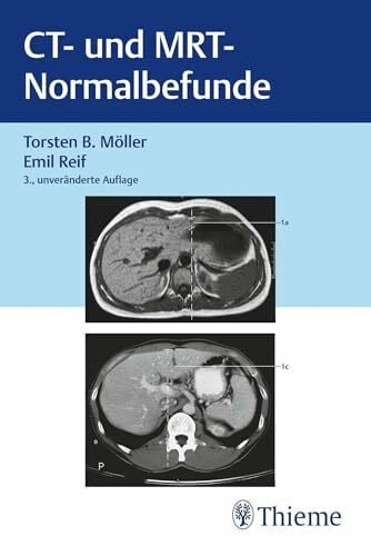 Reif, Emil CT und MRT Normalbefunde