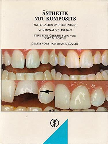 Lösche, Götz M Ästhetik mit Komposits: Materialien und Techniken