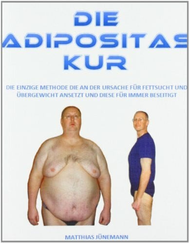 Junemann, Matthias Die Adipositas Kur