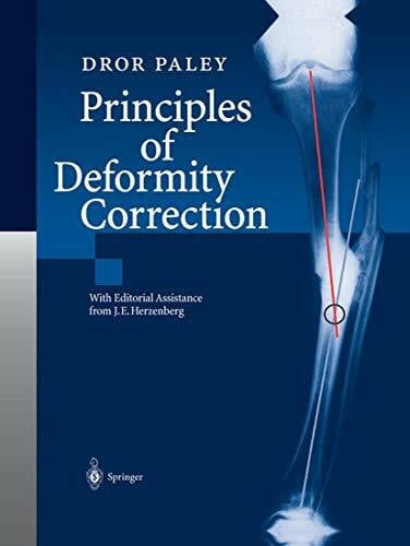 Herzenberg, J.E. Principles of Deformity Correction
