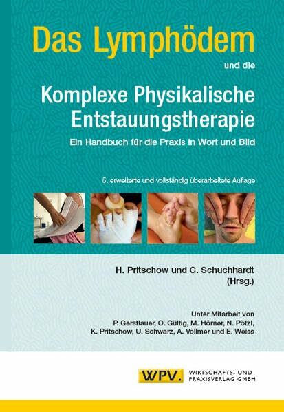 Pritschow, Hans Das Lymphödem und die Komplexe Physikalische Entstauungstherapie: Ein Handbuch für die Praxis in Wort und Bild