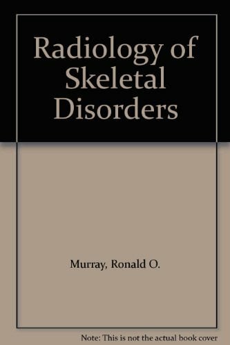 Jacobson, Harold G. Radiology of Skeletal Disorders