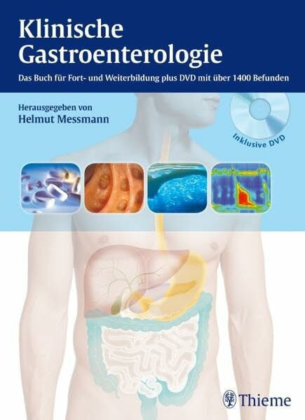 Messmann, Helmut Klinische Gastroenterologie: Das Buch für Fort- und Weiterbildung plus DVD mit über 1.000 Befunden: Das Buch für Fort- und Weiterbildung mit über 1400 Befunden