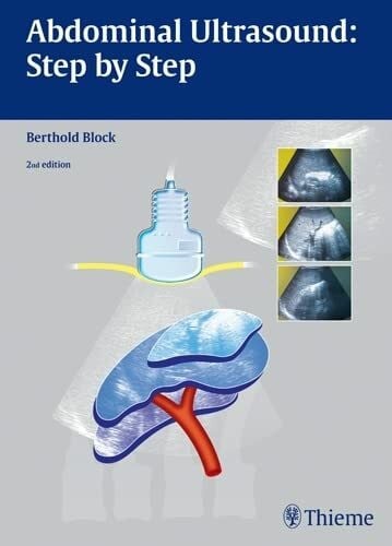 Block, Berthold Abdominal Ultrasound: Step by Step