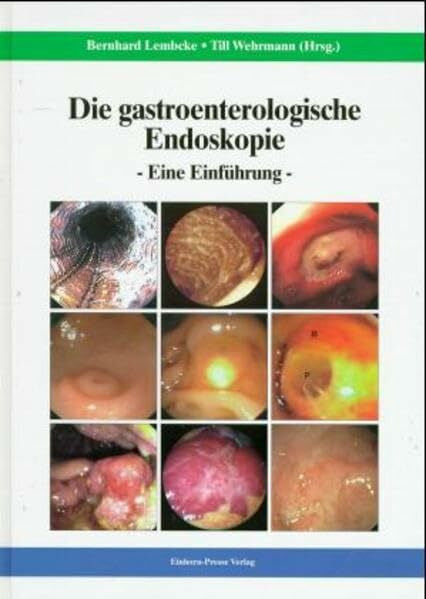 Lembcke, Bernhard Die gastroenterologische Endoskopie: Eine Einführung