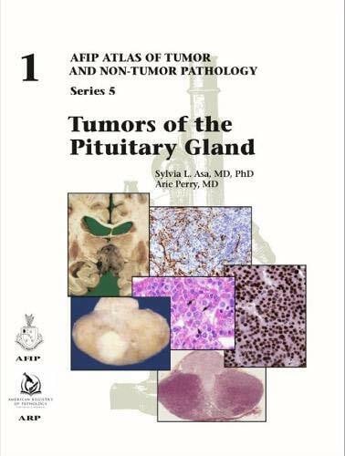 Perry, Arie Tumors of the Pituitary Gland (AFIP Atlas of Tumor and Non-Tumor Pathology, Series 5, Band 1)