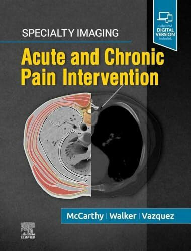 Walker MD FSIR, T. Gregory Specialty Imaging: Acute and Chronic Pain Intervention