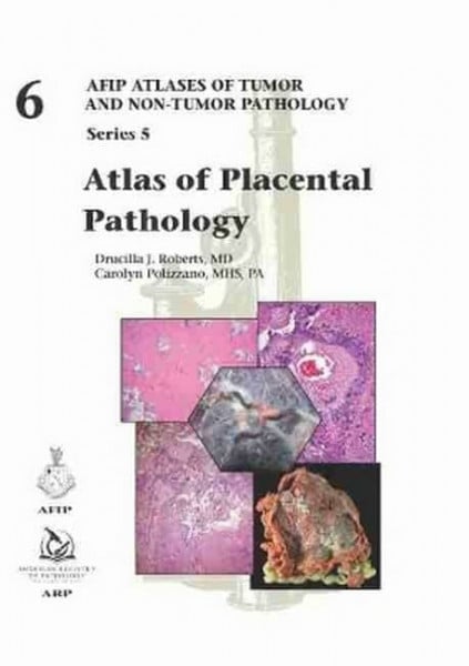 Polizzano, Carolyn Atlas of Placental Pathology (AFIP Atlas of Tumor and Non-Tumor Pathology, Series 5, Band 6)