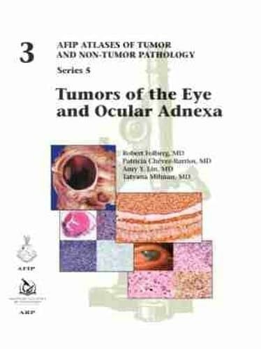 Chévez-Barrios, Patricia Tumors of the Eye and Ocular Adnexa (AFIP Atlas of Tumor and Non-Tumor Pathology, Series 5, Band 3)