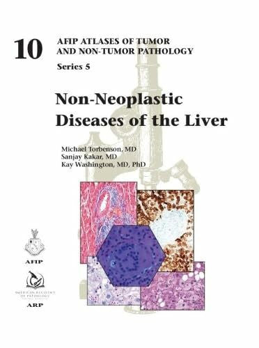 Washington, Kay Non-Neoplastic Diseases of the Liver (AFIP Atlas of Tumor and Non-Tumor Pathology, Series 5, Band 10)