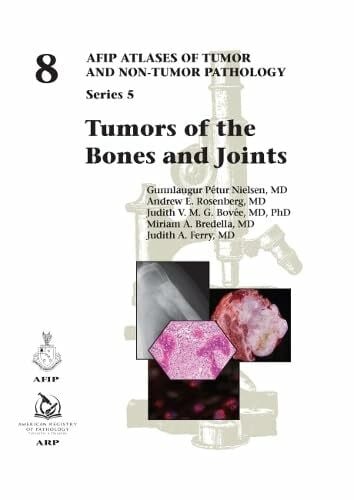 Ferry, Judith A. Tumors of the Bones and Joints (AFIP Atlases of Tumor and Non-tumor Pathology, Series 5, Band 8)