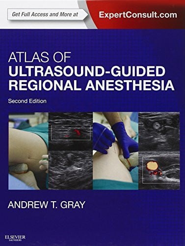 Gray, Andrew T. Atlas of Ultrasound-Guided Regional Anesthesia: Expert Consult.com. Enhanced Digital Version Included. Details inside