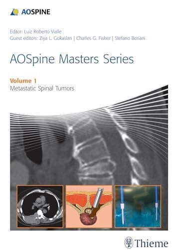Vialle, Luiz Roberto Gomes AOSpine Masters Series Volume 1: Metastatic Spinal Tumors