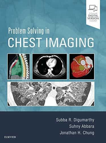 Chung MD, Jonathan H. Problem Solving in Chest Imaging