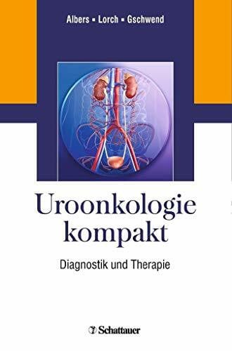 Albers, Peter Uroonkologie kompakt: Diagnostik und Therapie