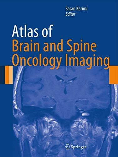 Karimi, Sasan Atlas of Brain and Spine Oncology Imaging (Atlas of Oncology Imaging)