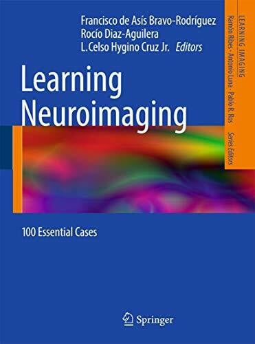Hygino da Cruz Jr., Luiz Celso Learning Neuroimaging: 100 Essential Cases (Learning Imaging)
