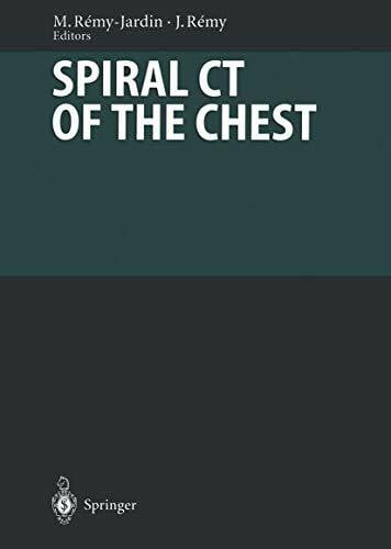 Baert, A.L. Spiral CT of the Chest: With Contributions by Numerous Experts (Diagnostic Imaging)