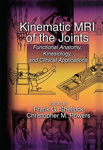 Powers, Christopher M. Kinematic MRI of the Joints: Functional Anatomy, Kinesiology, and Clinical Applications