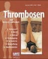 Maier, Karl F Thrombosen und Venenerkrankungen: Lebensstil, Beruf, Reisen, Vorbeugen, Symptome, Behandlung, Medikamente