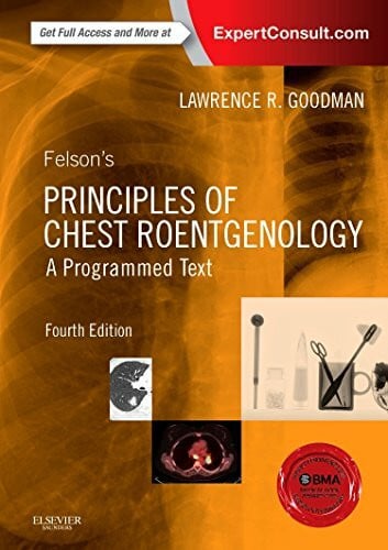 Goodman MD FAAC, Lawrence R. Felson's Principles of Chest Roentgenology, A Programmed Text