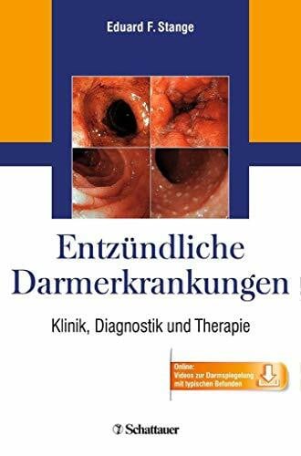 Stange, Eduard F. Entzündliche Darmerkrankungen: Klinik, Diagnostik und Therapie - Online: Videos zur Darmspiegelung mit typischen Befunden