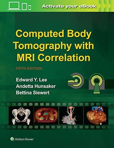 Siewert, Bettina Computed Body Tomography With MRI Correlation
