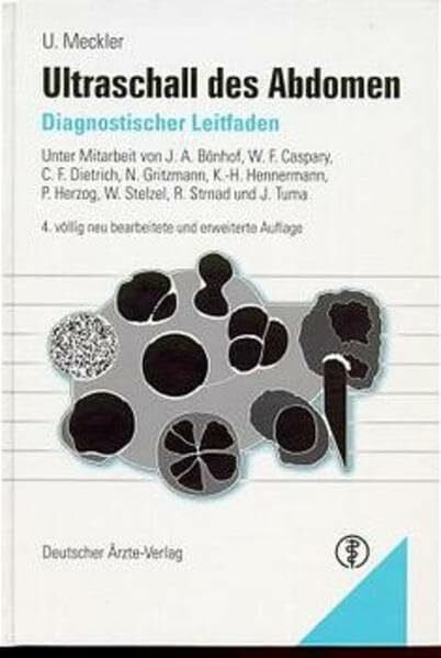 Meckler, Ulrich Ultraschall des Abdomen: Diagnostischer Leitfaden