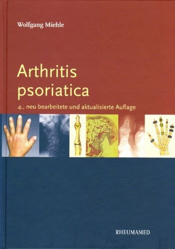 Miehle, Wolfgang Arthritis psoriatica