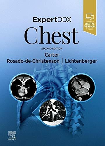 Lichtenberger III MD Maj USAF MC, John P. ExpertDDx: Chest
