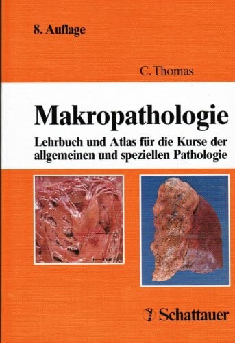 Thomas, Carlos Makropathologie: Lehrbuch und Atlas für die Kurse der allgemeinen und speziellen Pathologie