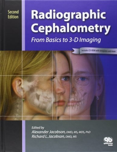 Alexander Jacobson Radiographic Cephalometry: From Basics to 3-D Imaging